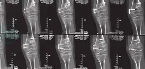 包含LPw&amp;?瘢$<婘?鋥r蜢的词条-爱游戏